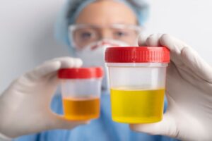 Bright Yellow Urine During Pregnancy